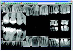 Save 15 minutes per FMX