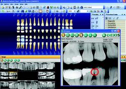 Images and multiple image functions– fully integrated on the patient chart
