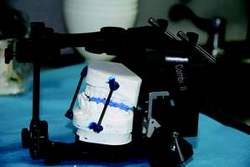 Figure 7-Combi II by WhipMix