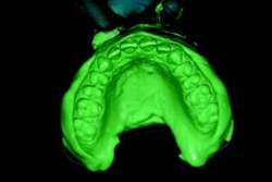 Figure 5-Full Arch Impression