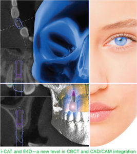 i-CAT and E4D—a new level in CBCT and CAD/CAM integration