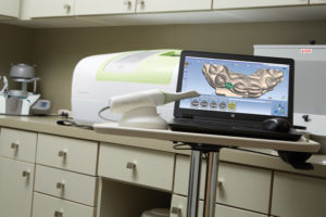 Planmeca CAD/CAM system