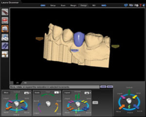 Figure 3. Digital restoration of number 20.