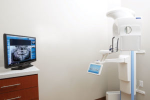 Imaging area