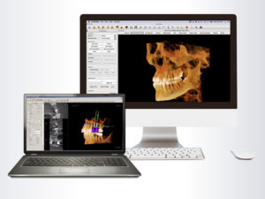 Invivo 5.4 and Invivo 5 for Mac are powerful CBCT 3D imaging applications specialized for implants, orthodontics, oral surgery, and restorative dentistry. Both offer fast, quality rendering and visualization on cone beam 3D scans and tools for accurate treatment plans.