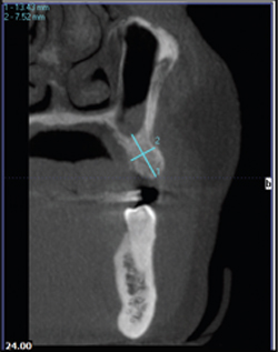 Figure 2. Cross-sectional display with precise measurements