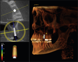 Figure 3. Compatibility with 3-D planning software
