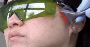 TMJ Treatment Still Image