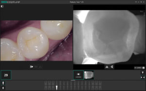 Digital photography images from DEXcam 4 HD