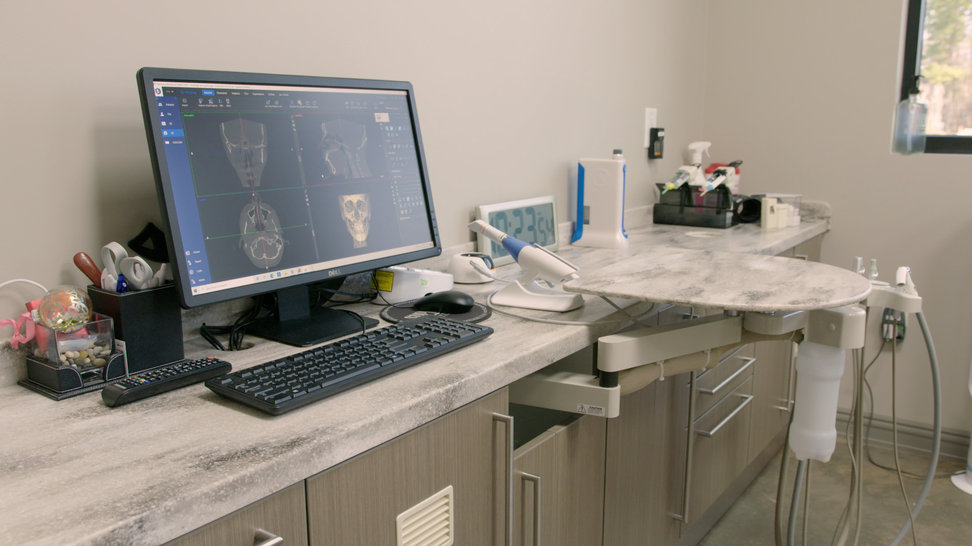 3D imaging paired with digital impressioning allows Dr. Suh to receive detailed and accurate images on the patient’s oral structure, leaving little room for error.