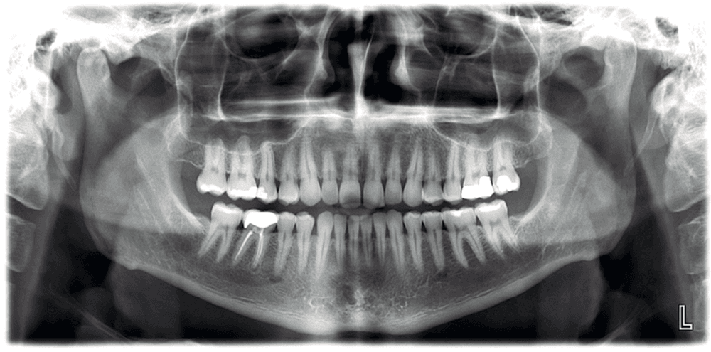 Planmeca ProMax® 3D