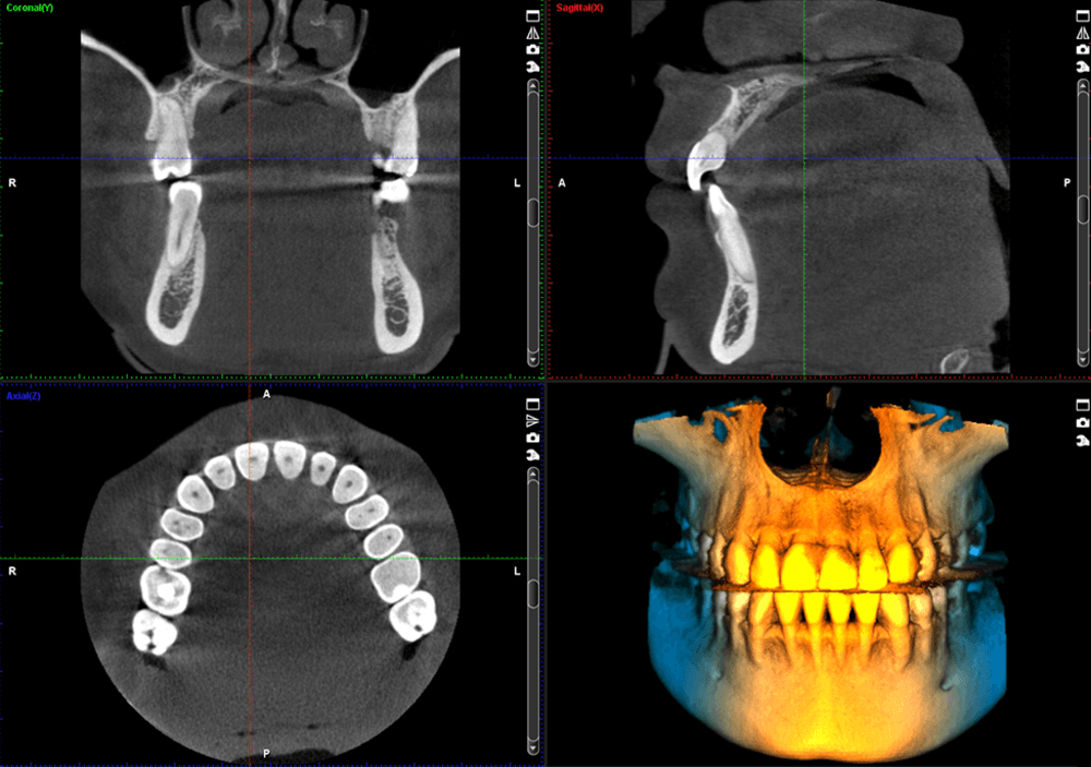 Planmeca ProMax® 3D