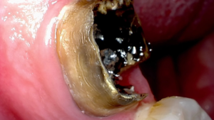 Image from high-definition cameras